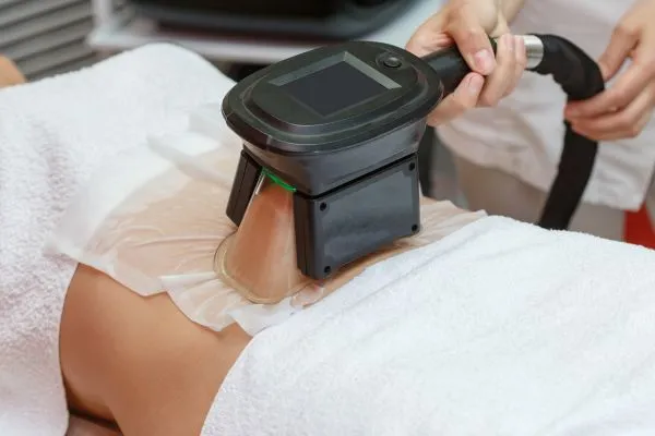 Image of person having fat freezing treatment to help weight gain Amesbury