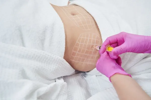 image of fat dissolving injections on love handles to help combat weight gain Amesbury