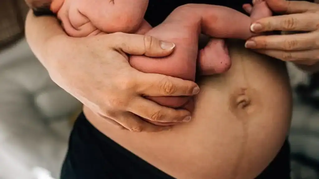 Why Is My Stomach Still Big After Pregnancy Amesbury?